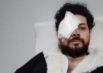 Şişli’de iki grup arasında çıkan silahlı kavgada maganda kurşunuyla gözünü kaybeden şarkıcı Şahan Dinç dehşet anlarını anlattı.