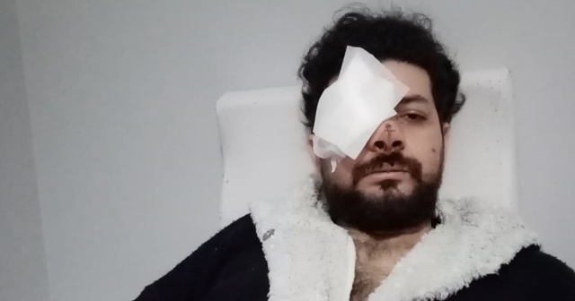 Şişli’de iki grup arasında çıkan silahlı kavgada maganda kurşunuyla gözünü kaybeden şarkıcı Şahan Dinç dehşet anlarını anlattı.